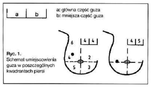 Biopsja