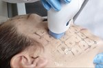 Face Treatment.jpg