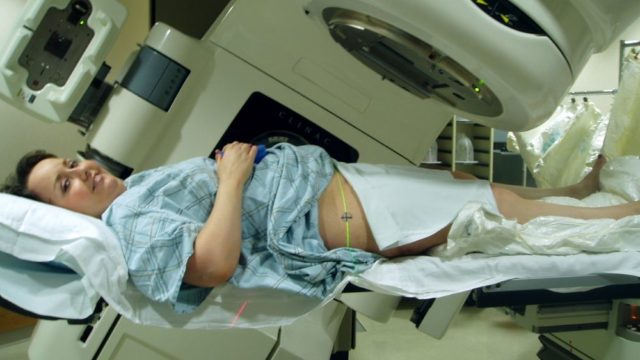 radioterapia